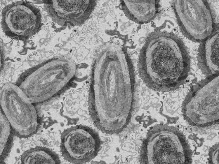 Reportan primer caso de viruela del mono en Nuevo León