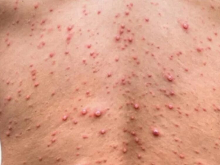 La viruela del mono de humano a perro sí es posible; esto recomienda la OMS