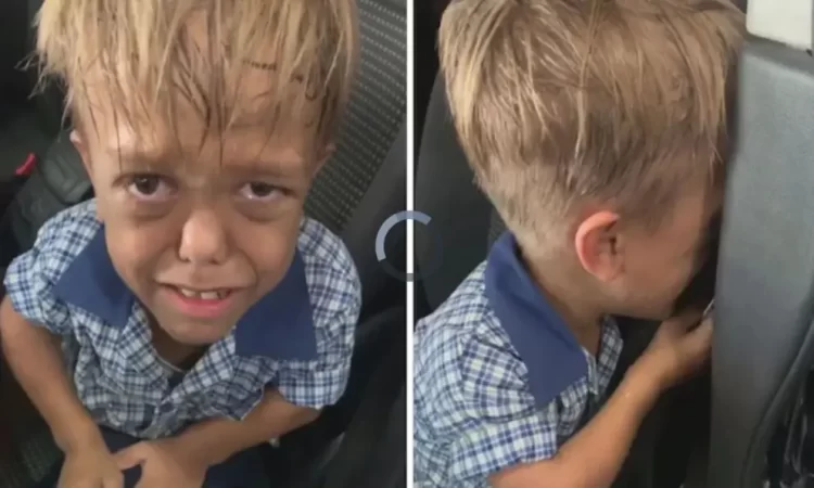 De sufrir bullying por su enfermedad a triunfar en Hollywood; esta es la historia de Quaden Bayles