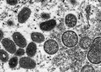 Van 33 casos de viruela símica en Jalisco