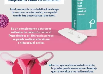 Nueva prueba para medir el riesgo de contraer cáncer cervicouterino, sin dolor