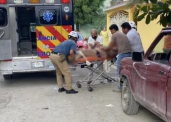 Se quema carnicero con aceite hirviendo