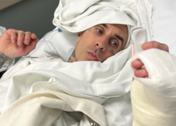 Baterista de Blink 182 comparte fotografía de su cirugía