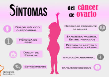 Cáncer de ovario es más letal que el de mama; 70% de casos se detecta en forma tardía