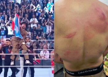Así quedo la espalda de Bad Bunny tras su combate en la WWE