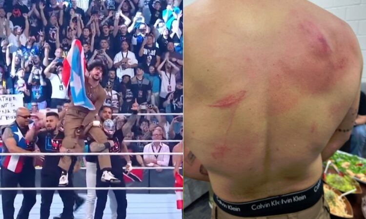 Así quedo la espalda de Bad Bunny tras su combate en la WWE