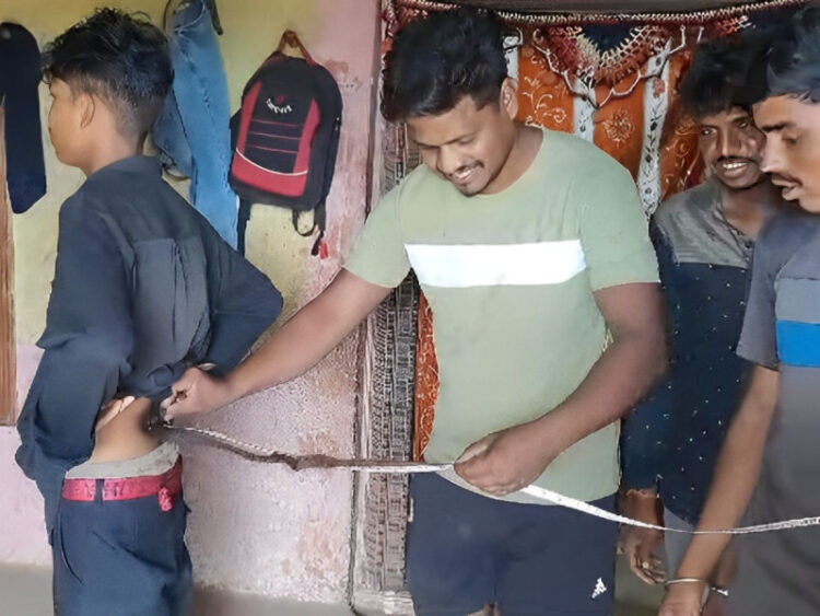 Joven es ‘adorado’ como dios hindú ¡por tener cola!… pero se la quiere quitar