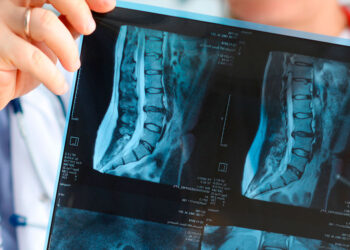 Japón encabeza una misión para explorar el universo a través de rayos X