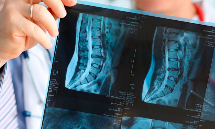 Japón encabeza una misión para explorar el universo a través de rayos X