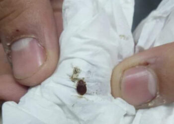 Recomiendan no aplastar las chinches, hay que aplicar insecticidas