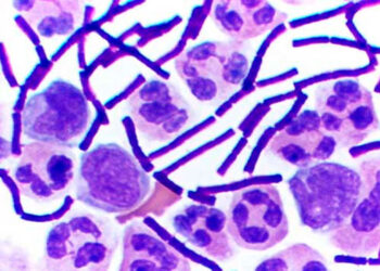 La OMS alerta sobre un brote de Ántrax en Zambia