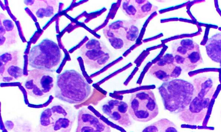 La OMS alerta sobre un brote de Ántrax en Zambia