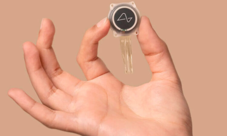 Neuralink, de Elon Musk, realiza con éxito la primera implantación de un chip cerebral en humanos