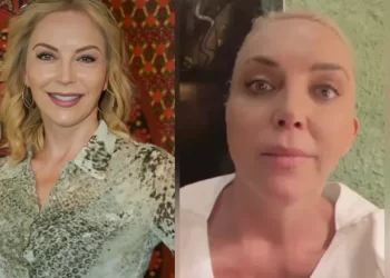 Actriz tamaulipeca Laura Flores sufre un microinfarto cerebral por tratamiento estético