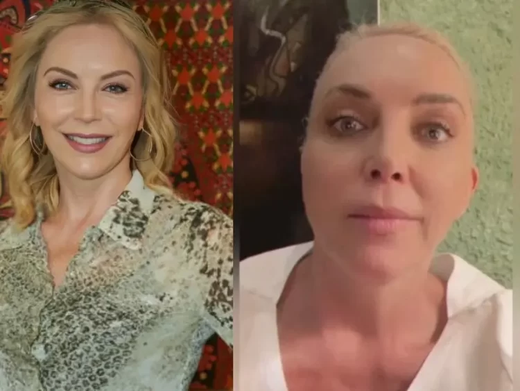 Actriz tamaulipeca Laura Flores sufre un microinfarto cerebral por tratamiento estético