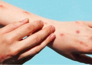 Ganador de 53 millones en casino hospitalizado por infarto