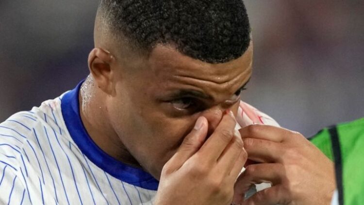Mbappé sufre fractura de nariz en el debut de Francia en la Eurocopa 2024