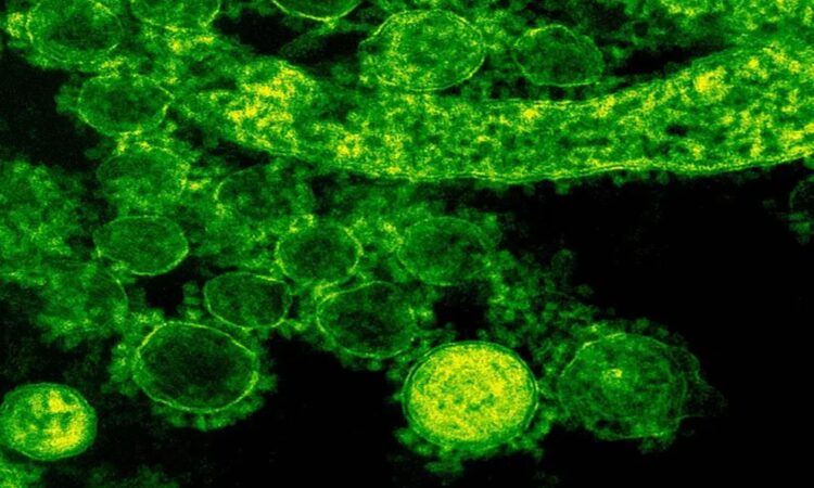 Japón registra 77 muertes por bacteria carnívora en 2024