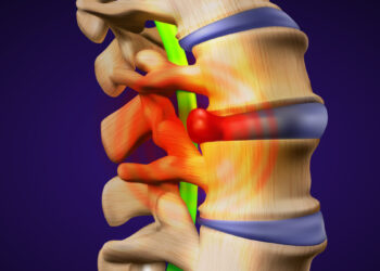 Neurocirujano en León