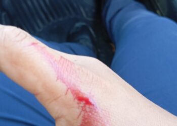 Reprueba Tránsito Municipal de Victoria agresión a agente vial por influyente