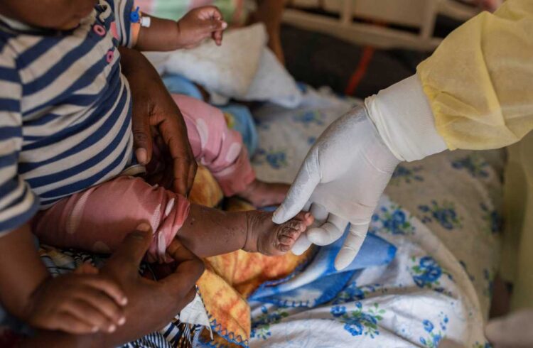 OMS declara nueva emergencia mundial por brote de viruela del mono