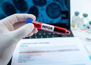 Sin casos de mpox en Latinoamérica, pero activan vigilancia