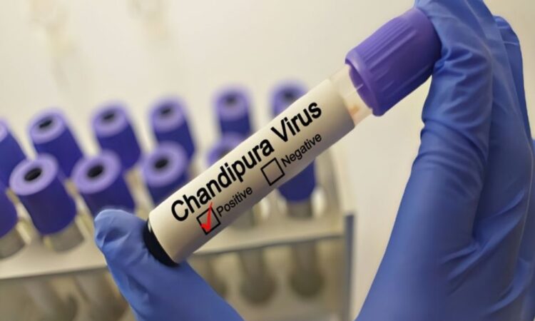 El mortal virus Chandipura: una amenaza creciente