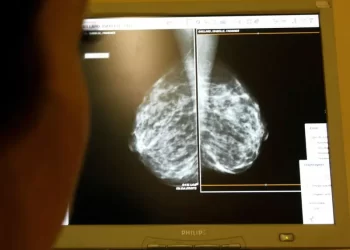 FDA aprueba nuevo tratamiento contra el cáncer de mama en etapas tempranas