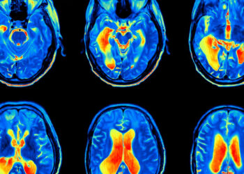 Efectos del confinamiento en el cerebro adolescente