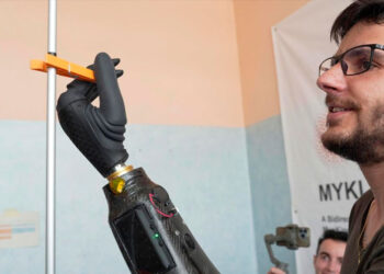 Mano robótica controlada con imanes revoluciona la tecnología protésica