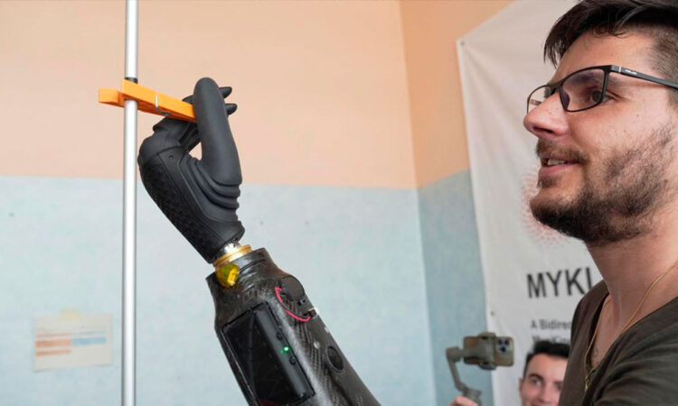 Mano robótica controlada con imanes revoluciona la tecnología protésica