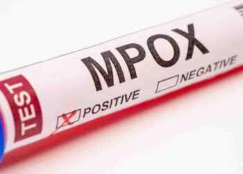 Mpox en África central expone falta de apoyo internacional