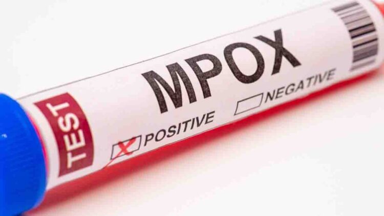 Mpox en África central expone falta de apoyo internacional