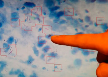 La tuberculosis vuelve a ser la principal causa de muerte infecciosa