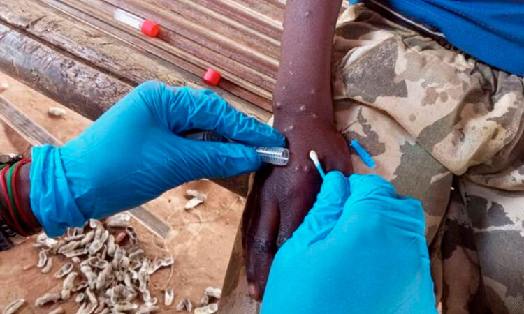 OMS mantiene emergencia por mpox ante aumento de casos y muertes