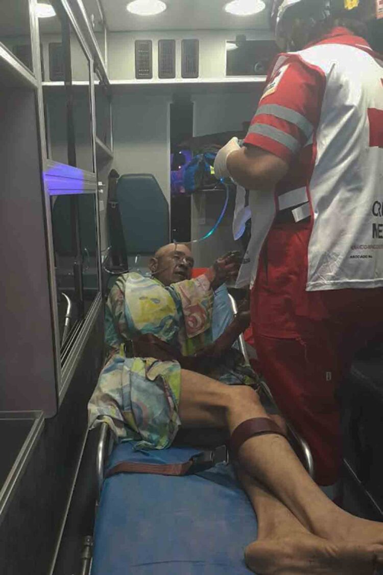 Se queda dormido con el cigarro encendido y… se quema 50% de su cuerpo