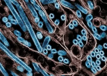 Muere el primer paciente enfermo con gripe aviar en EU