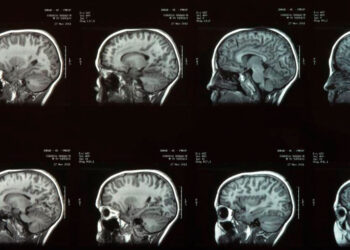 ONU propone crear neuroderechos para proteger la privacidad mental de las personas