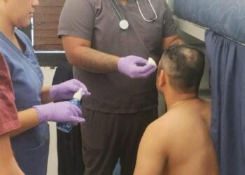 Guardia estatal herido al dispararse su pistola por accidente