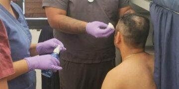 Guardia estatal herido al dispararse su pistola por accidente