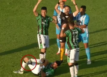 Jugador de futbol sufre espeluznante fractura de pierna en Argentina