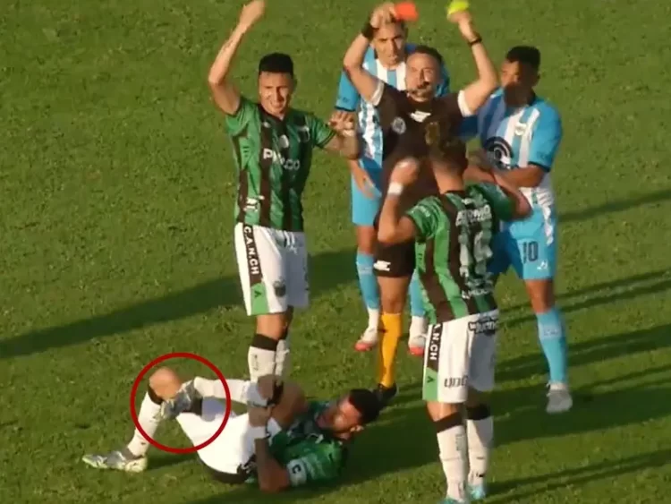 Jugador de futbol sufre espeluznante fractura de pierna en Argentina