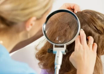 El calor acelera el ciclo de vida del piojo y aumenta plaga en esta época