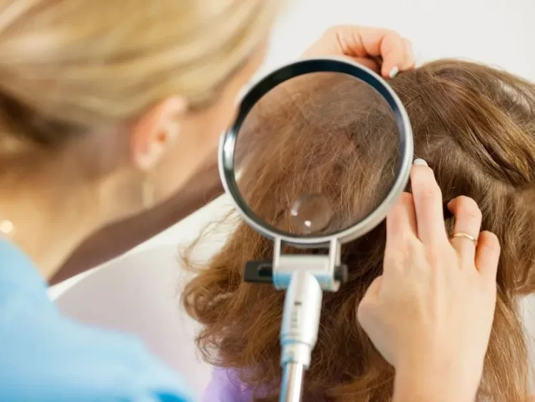 El calor acelera el ciclo de vida del piojo y aumenta plaga en esta época