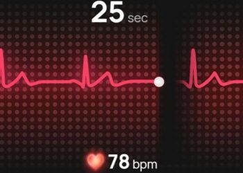 ¿Por qué los relojes inteligentes son esenciales para los usuarios preocupados por su salud?