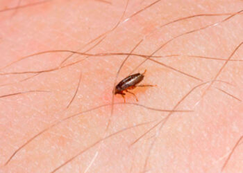 EU detecta caso de peste bubónica en California