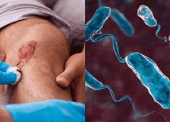 Alerta por bacteria carnívora en mariscos por aumento de muertes y contagios