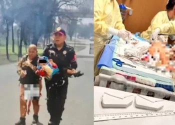 Nieta de ‘abuelita heroína’ recibe injertos en manos, piernas y cabeza