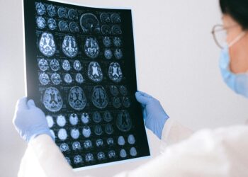 La OMS advierte que los trastornos neurológicos afectan al 42% de la población mundial