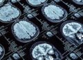 Desarrollan IA que reduce en 90% el tiempo de resonancias cerebrales